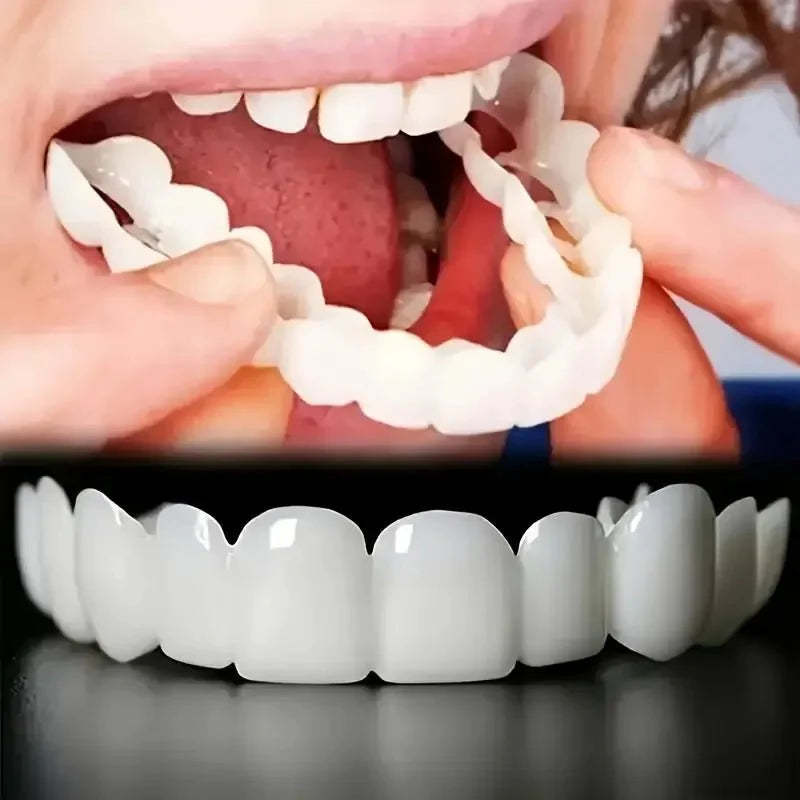 2 Pairs Snap - On Teeth Covers – Natural Look, Instant Smile Upgrade - My Store